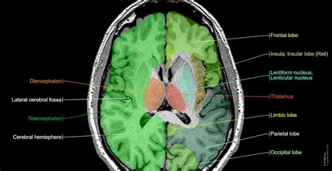 e anatomy imaios|brain images anatomy.